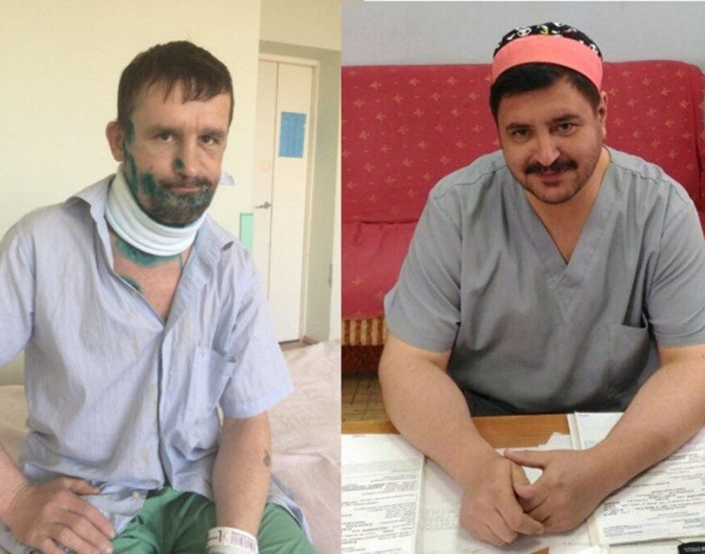 Красноярские врачи спасли вахтовика с перерезанным на пилораме горлом